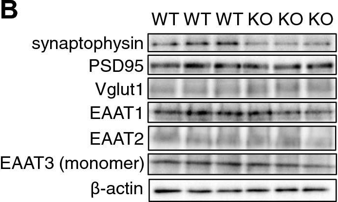 Fig.3.B showing Western Blotting from the publication: Ndufs4 ablation decreases synaptophysin expression in hippocampus.
