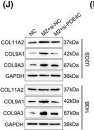 Fig.8.J showing Western Blotting from the publication: Analysis of the effects of M2 macrophage-derived PDE4C on the prognosis, metastasis and immunotherapy benefit of osteosarcoma.