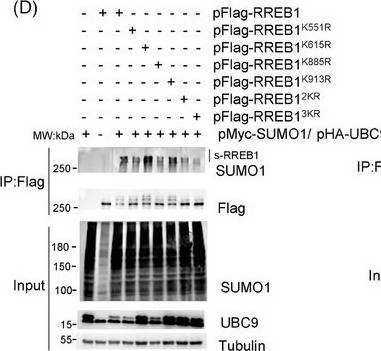 Fig.2.D showing Western Blotting in a Homo sapiens (Human) sample from the publication: The SUMOylated RREB1 interacts with KDM1A to induce 5-fluorouracil resistance via upregulating thymidylate synthase and activating DNA damage response pathway in colorectal cancer.