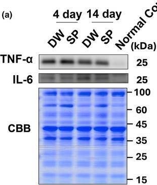 Fig.6.A showing Western Blotting from the publication: Effect of spermidine intake on overload-induced skeletal muscle hypertrophy in male mice.