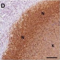 Fig.4.D showing Immunohistochemistry in a Bos taurus (Bovine) sample from the publication: The C3HeB/FeJ mouse model recapitulates the hallmark of bovine tuberculosis lung lesions following Mycobacterium bovis aerogenous infection.