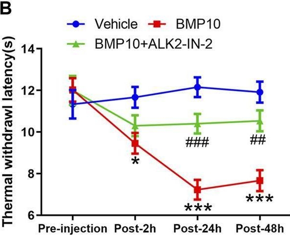 Fig.8.B from the publication: BMP10 accelerated spinal astrocytic activation in neuropathic pain via ALK2/smad1/5/8 signaling.