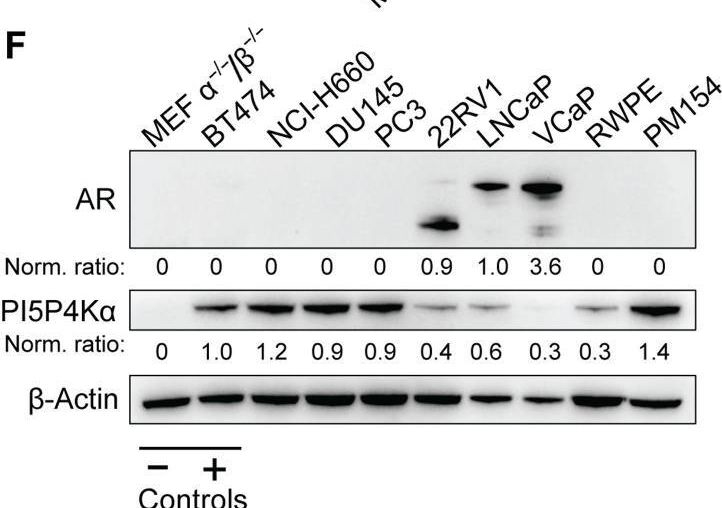 Fig.1.F showing Western Blotting from the publication: PI5P4Kα supports prostate cancer metabolism and exposes a survival vulnerability during androgen receptor inhibition.