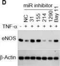 Fig.5.D showing Western Blotting from the publication: Circulating miRNAs Associated with Dysregulated Vascular and Trophoblast Function as Target-Based Diagnostic Biomarkers for Preeclampsia.