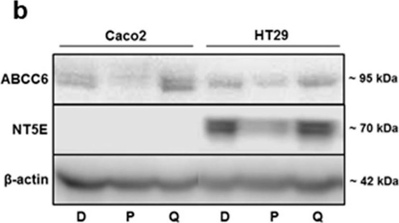 Fig.2.B showing Western Blotting from the publication: The Expression Level of ABCC6 Transporter in Colon Cancer Cells Correlates with the Activation of Different Intracellular Signaling Pathways.