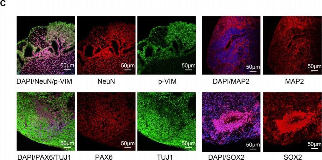 Fig.8.C showing Immunohistochemistry-immunofluorescence from the publication: Neuroprotective Effects of Qi Jing Wan and Its Active Ingredient Diosgenin Against Cognitive Impairment in Plateau Hypoxia.