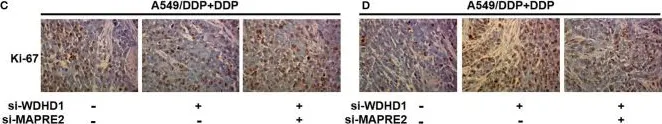 Fig.5.C,D showing Immunohistochemistry in a Homo sapiens (Human) sample from the publication: WDHD1 Leads to Cisplatin Resistance by Promoting MAPRE2 Ubiquitination in Lung Adenocarcinoma.