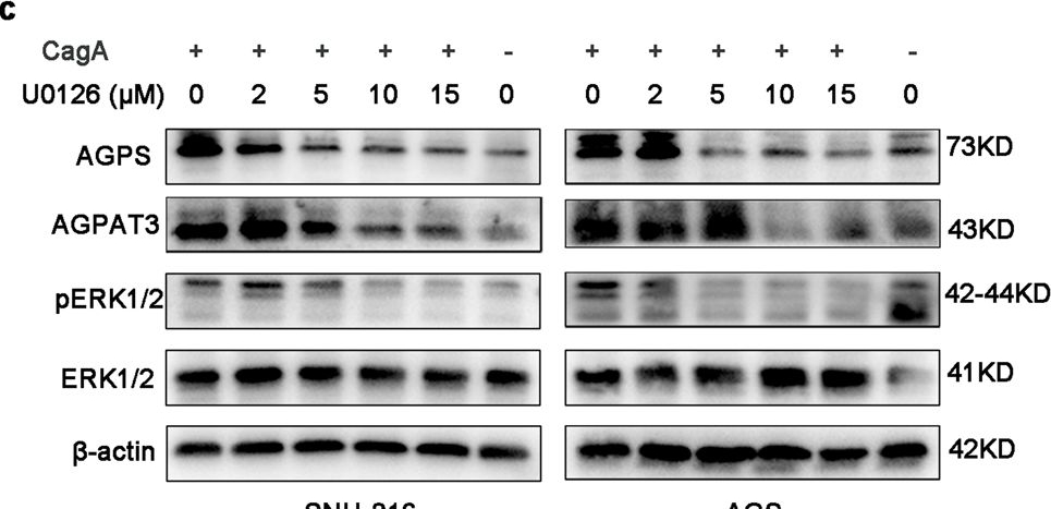 Fig.4.C showing Western Blotting from the publication: Helicobacter pylori CagA-mediated ether lipid biosynthesis promotes ferroptosis susceptibility in gastric cancer.