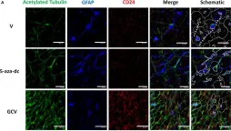 Fig.6.A showing Immunocytochemistry in a Mus musculus (House mouse) sample from the publication: Organized Neurogenic-Niche-Like Pinwheel Structures Discovered in Spinal Cord Tissue-Derived Neurospheres.