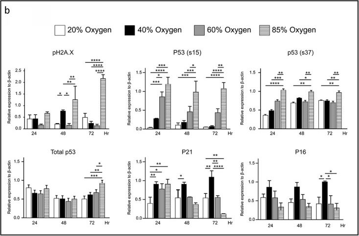 Fig.5.B from the publication: Low hyper-oxygen exposure induces p21-dependent p53-independent senescence in alveolar cells.