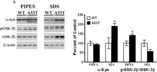 Fig.4.A showing Western Blotting from the publication: Tauopathic changes in the striatum of A53T α-synuclein mutant mouse model of Parkinson's disease.