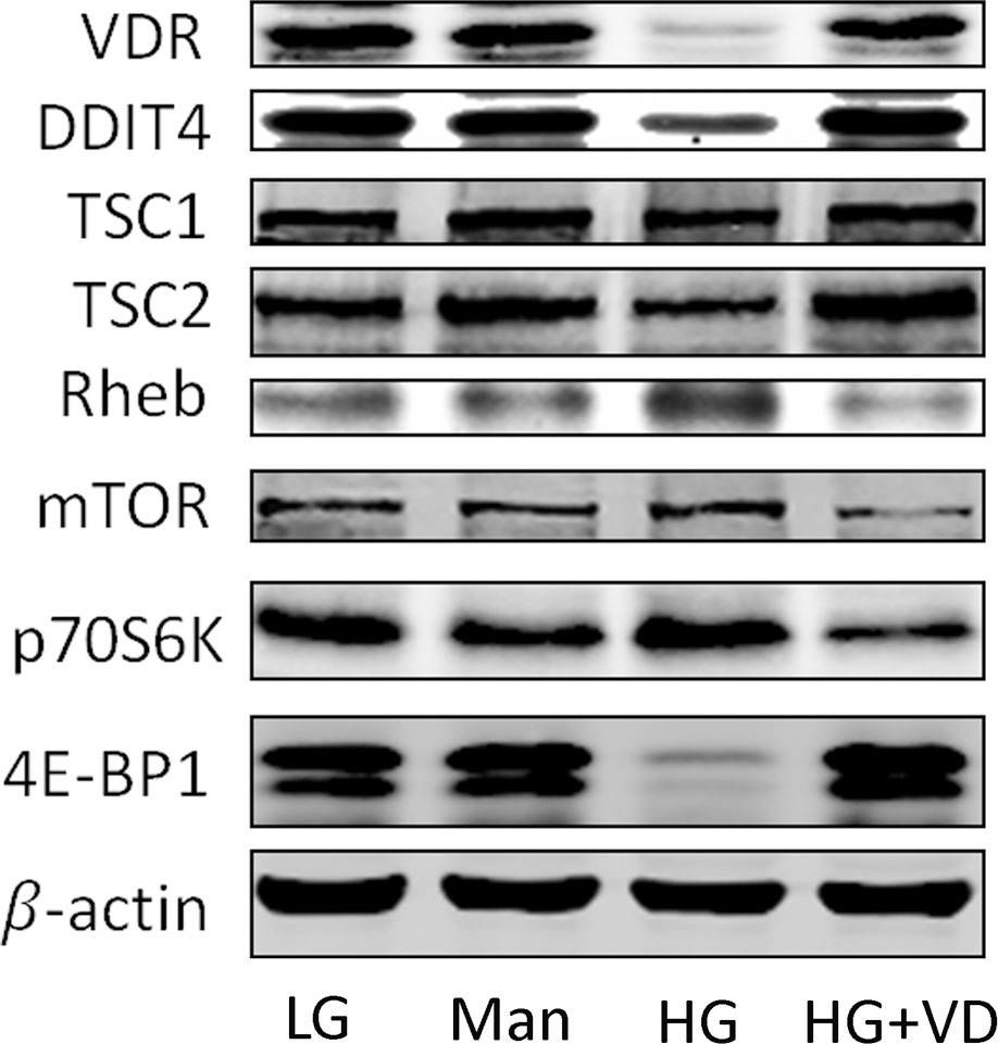 Fig.3.A showing Western Blotting in a Rattus norvegicus (Rat) sample from the publication: 1,25-Dihydroxyvitamin D3 inhibits the proliferation of rat mesangial cells induced by high glucose via DDIT4.
