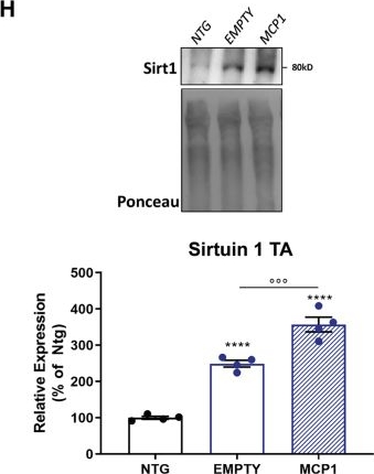 Fig.3.H showing Western Blotting from the publication: Boosting the peripheral immune response in the skeletal muscles improved motor function in ALS transgenic mice.