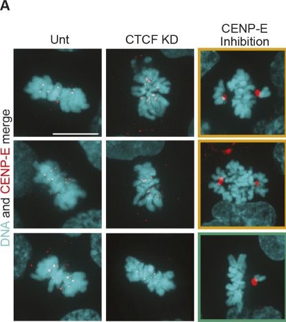 Fig.3.A showing Immunocytochemistry-immunofluorescence in a Homo sapiens (Human) sample from the publication: CTCF maintains centromere function and mitotic fidelity.