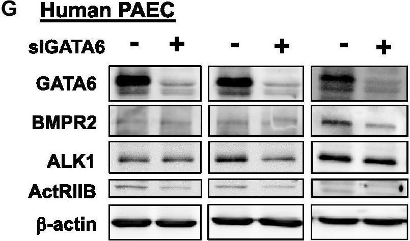 Fig.5.G showing Western Blotting in a Homo sapiens (Human) sample from the publication: GATA6 coordinates cross-talk between BMP10 and oxidative stress axis in pulmonary arterial hypertension.