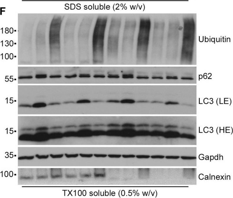 An Essential Role for Calnexin in ER-Phagy and the Unfolded Protein Response.