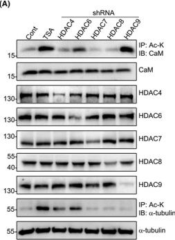Fig.3.A showing Western Blotting in a Homo sapiens (Human) sample from the publication: HDAC9-mediated calmodulin deacetylation induces memory impairment in Alzheimer's disease.