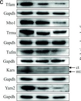 Fig.5.C showing Western Blotting in a Danio rerio (Zebrafish) sample from the publication: Deletion of Gtpbp3 in zebrafish revealed the hypertrophic cardiomyopathy manifested by aberrant mitochondrial tRNA metabolism.