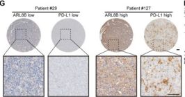 ピークハンド＋α カリブ① PD-L1 (E1L3N®) XP® Rabbit mAb | Cell Signaling Technology