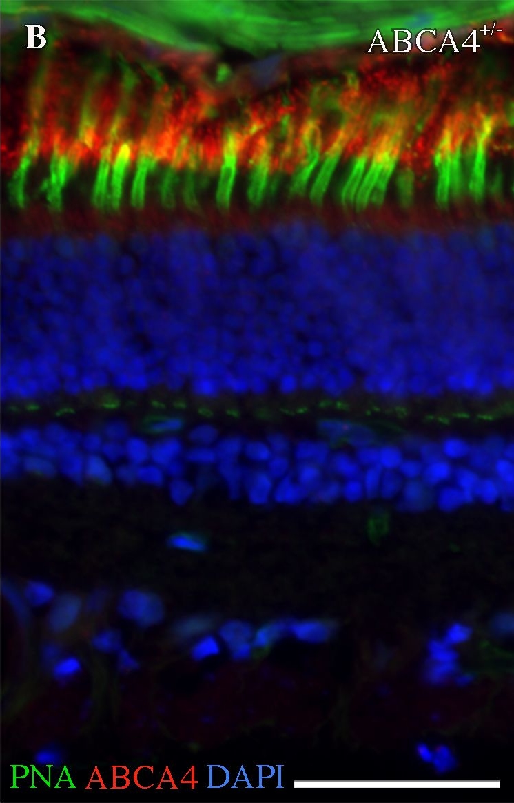 ABCA4 antibodies - Antibody search engine - CiteAb