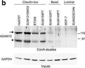 Fig.1.B showing Western Blotting in a Homo sapiens (Human) sample from the publication: Metalloprotease-disintegrin ADAM12 actively promotes the stem cell-like phenotype in claudin-low breast cancer.