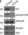 Fig.5.F showing Western Blotting in a Mus musculus (House mouse) sample from the publication: Integrin-linked kinase regulates the niche of quiescent epidermal stem cells.