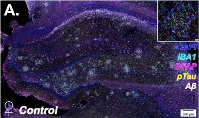 Fig.4.A showing Immunohistochemistry-immunofluorescence in a Rattus norvegicus (Rat) sample from the publication: Treadmill training induces sex-dependent changes in hippocampal epigenetic patterns and plaque-associated microglial morphology in aged TgF344 rats.