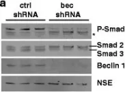 Fig.7.A showing Western Blotting in a Mus musculus (House mouse) sample from the publication: Beclin 1 regulates neuronal transforming growth factor-β signaling by mediating recycling of the type I receptor ALK5.
