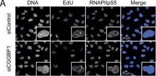 Fig.3.A showing Immunocytochemistry-immunofluorescence in a Homo sapiens (Human) sample from the publication: The CGG triplet repeat binding protein 1 counteracts R-loop induced transcription-replication stress.