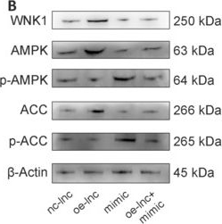 Fig.5.B showing Western Blotting in a Homo sapiens (Human) sample from the publication: Lnc_011797 promotes ferroptosis and aggravates white matter lesions.