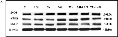 Fig.4.A showing Western Blotting from the publication: Combustion smoke-induced inflammation in the olfactory bulb of adult rats.