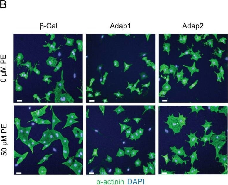 Fig.3.B showing Immunocytochemistry-immunofluorescence from the publication: ArfGAP with Dual Pleckstrin Homology Domains 2 Promotes Hypertrophy of Cultured Neonatal Cardiomyocytes.