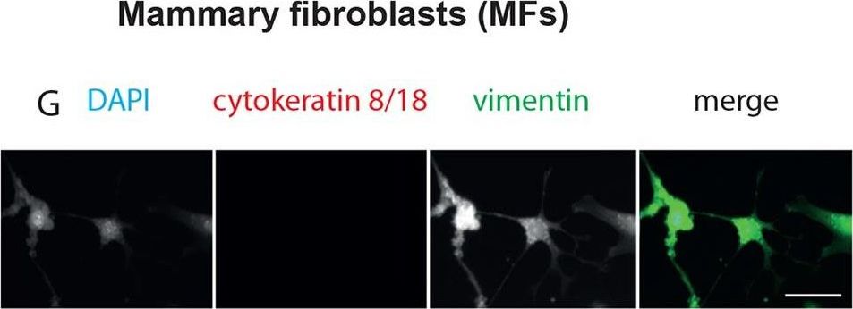 Epithelial and stromal circadian clocks are inversely regulated by their mechano-matrix environment.