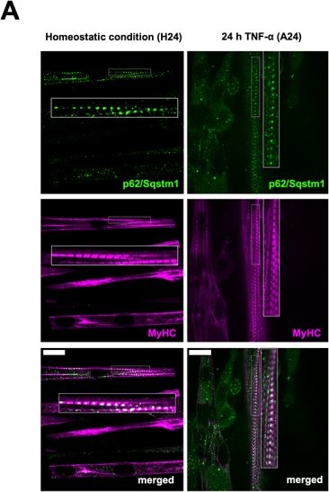 Fig.6.A showing Immunohistochemistry-immunofluorescence in a Mus musculus (House mouse) sample from the publication: Autophagy selectively clears ER in TNF-α-induced muscle atrophy.