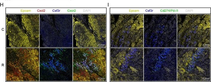 Fig.5.H showing Immunohistochemistry-immunofluorescence in a Mus musculus (House mouse) sample from the publication: A Novel Self-Regulated, Non-Directional Magnetic Thermos-Brachytherapy 125I Seed Enhances Anticancer Efficacy by Rescuing Immune Escape.