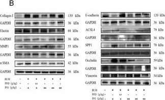 Fig.14.B showing Western Blotting from the publication: SPP1 and MMP1 as key therapeutic targets of Jingfang Granule in idiopathic pulmonary fibrosis: integrated bioinformatics and machine learning analysis.