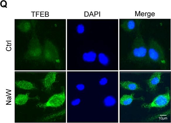 Fig.4.Q showing Immunocytochemistry-immunofluorescence from the publication: Modulation of anti-cardiac fibrosis immune responses by changing M2 macrophages into M1 macrophages.