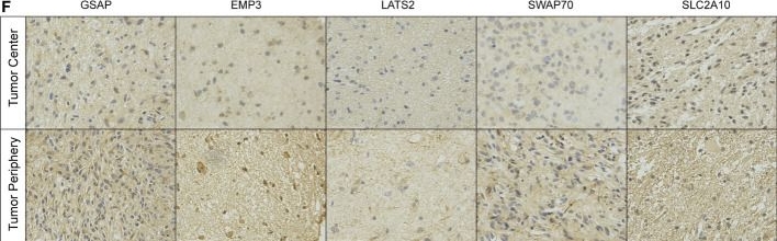 Fig.9.F showing Immunohistochemistry from the publication: Integrated analysis of genome-wide DNA methylation and cancer-associated fibroblasts identified prognostic biomarkers and immune checkpoint blockade in lower grade gliomas.