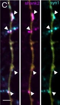 Fig.1.C showing Immunohistochemistry-immunofluorescence from the publication: Multifactorial approach is needed to unravel the maturation phases of human neurons derived from induced pluripotent stem cells.
