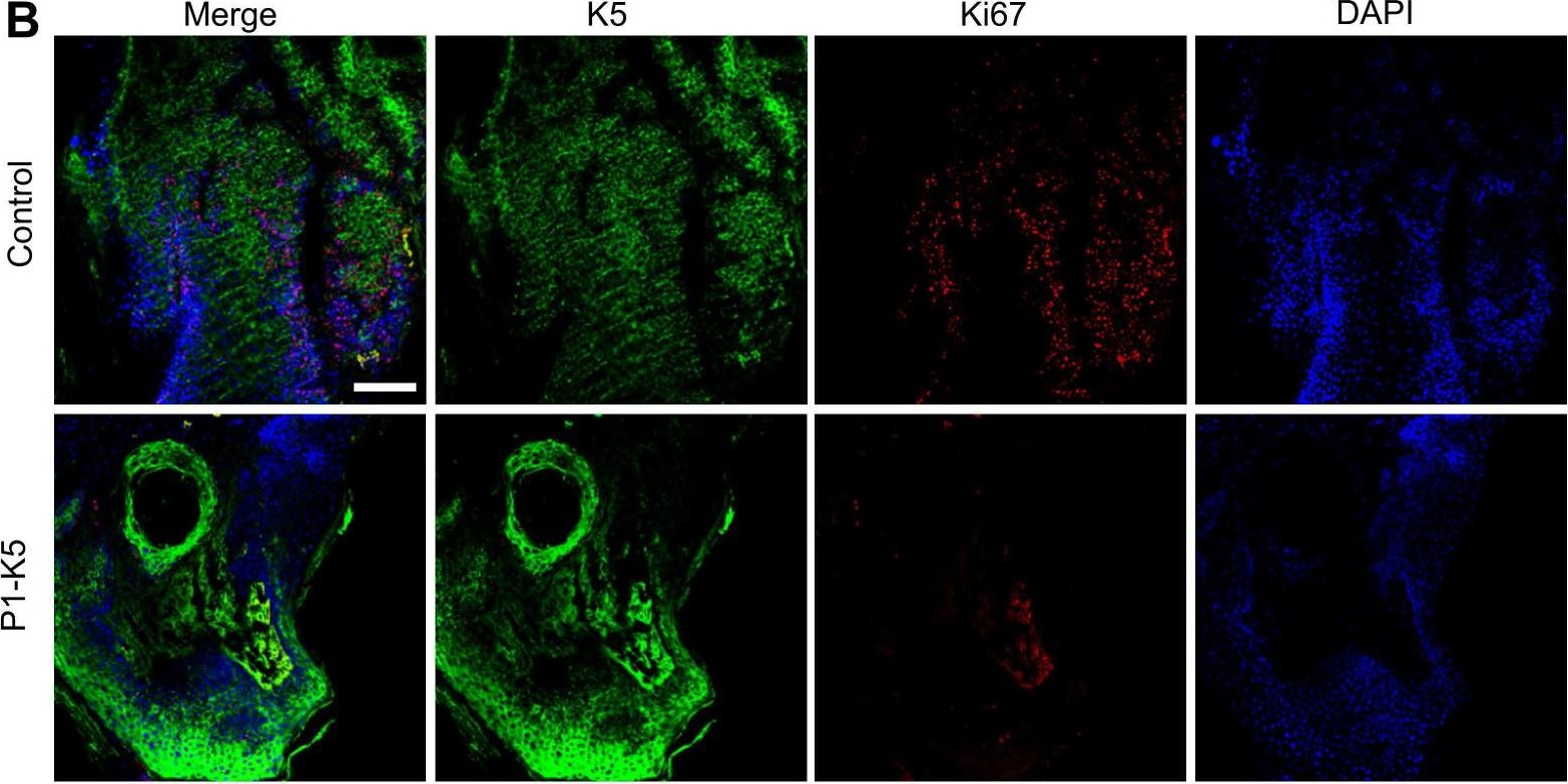 PINCH-1 promotes IGF-1 receptor expression and skin cancer progression through inhibition of the GRB10-NEDD4 complex.