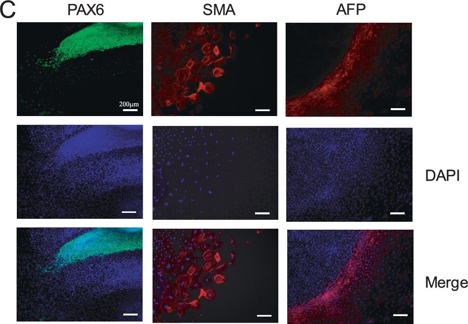 Fig.3.C showing Immunocytochemistry-immunofluorescence from the publication: Herpes simplex encephalitis due to a mutation in an E3 ubiquitin ligase.