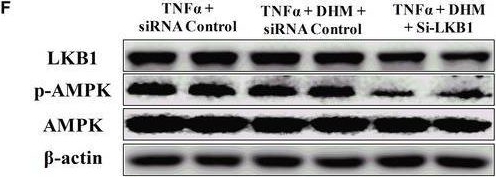 Fig.7.F showing Western Blotting in a Mus musculus (House mouse) sample from the publication: Dihydromyricetin resists inflammation-induced muscle atrophy via ryanodine receptor-CaMKK-AMPK signal pathway.