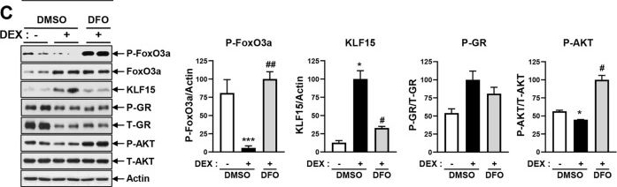 Fig.4.C showing Western Blotting in a Mus musculus (House mouse) sample from the publication: Deferoxamine prevents dexamethasone-induced muscle atrophy by reducing MuRF1 and atrogin-1.