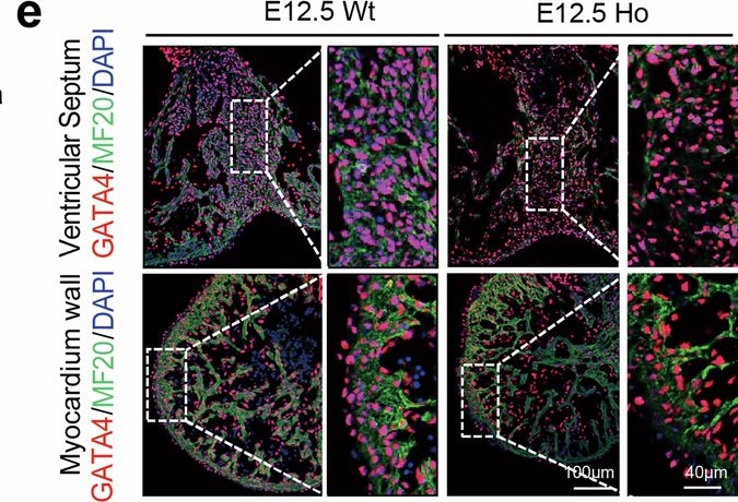Fig.4.E showing Immunohistochemistry-immunofluorescence from the publication: Maternal cholesterol deficiency predisposes congenital heart defects risk.