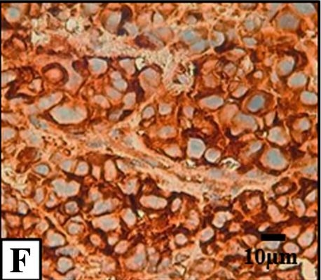 Fig.3.F showing Immunohistochemistry-paraffin in a Mus musculus (House mouse) sample from the publication: Vitronectin as a molecular player of the tumor microenvironment in neuroblastoma.