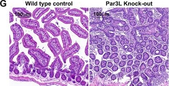 Fig.1.G showing Immunohistochemistry in a Mus musculus (House mouse) sample from the publication: Polarity protein Par3L deletion causes chromosomal segregation defects and tumorigenesis.