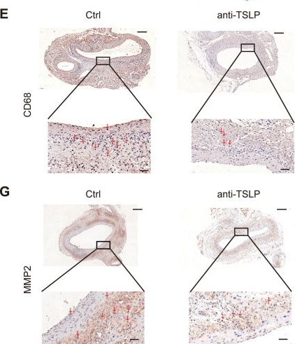 Fig.3.E showing Immunohistochemistry from the publication: Thymic stromal lymphopoietin promotes abdominal aortic aneurysm formation by regulating macrophage polarization.