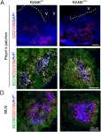Fig.3.A showing Immunocytochemistry in a Mus musculus (House mouse) sample from the publication: Increased Abundance of M Cells in the Gut Epithelium Dramatically Enhances Oral Prion Disease Susceptibility.