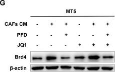 Fig.2.G showing Western Blotting in a Mus musculus (House mouse) sample from the publication: CAFs Homologous Biomimetic Liposome Bearing BET Inhibitor and Pirfenidone Synergistically Promoting Antitumor Efficacy in Pancreatic Ductal Adenocarcinoma.