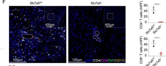 Fig.5.F showing Immunohistochemistry-immunofluorescence in a Homo sapiens (Human) sample from the publication: Targeting the Mapk13-Tcf1-Slc7a5 Axis via One-Carbon Metabolic Regulation to Prevent Chronic Allograft Vasculopathy.